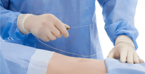 Intended medical procedure