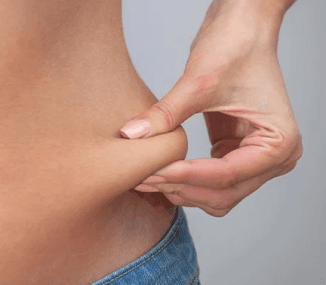 Liposuction procedure