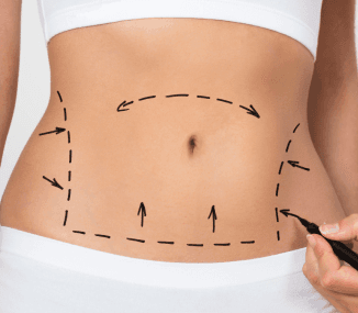 Surgery marking